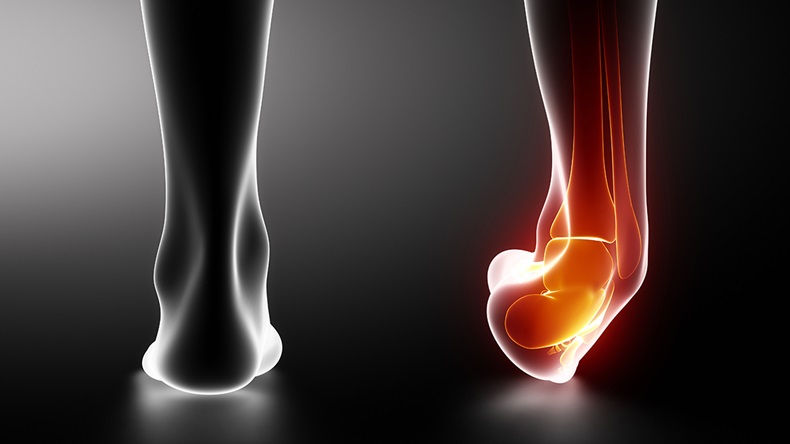 Ankle injury (CLIPAREA l Custom media/Shutterstock.com)